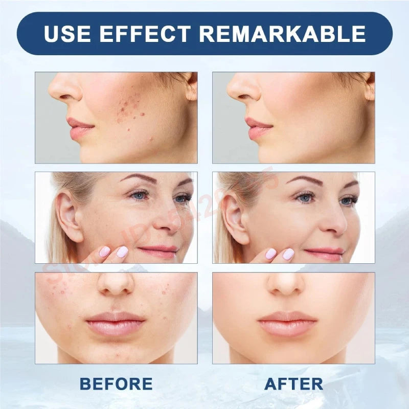 2026 NAD PDRN Skin Rejuvenation Repair Cells Hyaluronic Acid Promoting Bootser Collagen Cell Renewald Essence Korean Cosmetics